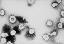 トムコットン上院議員 コロナウイルス陰謀説に言及 Fifth US case