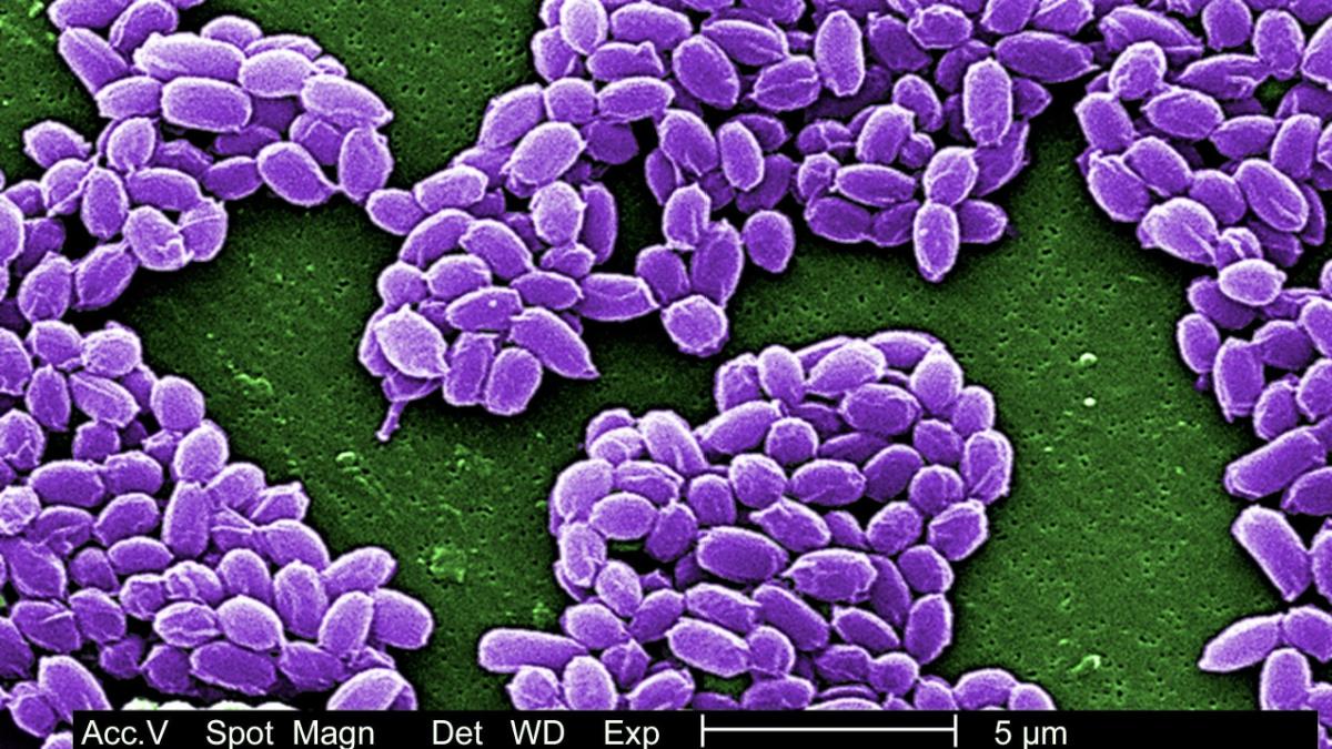 ロシア 炭疽菌感染者が病院から脱走する